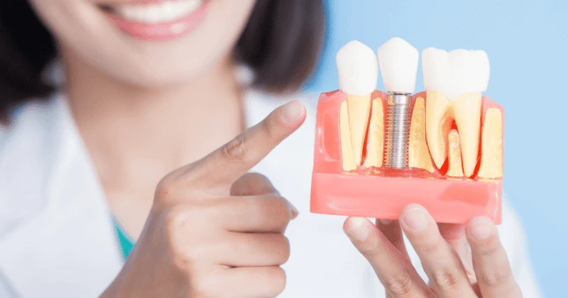 Advanced dental implant treatment