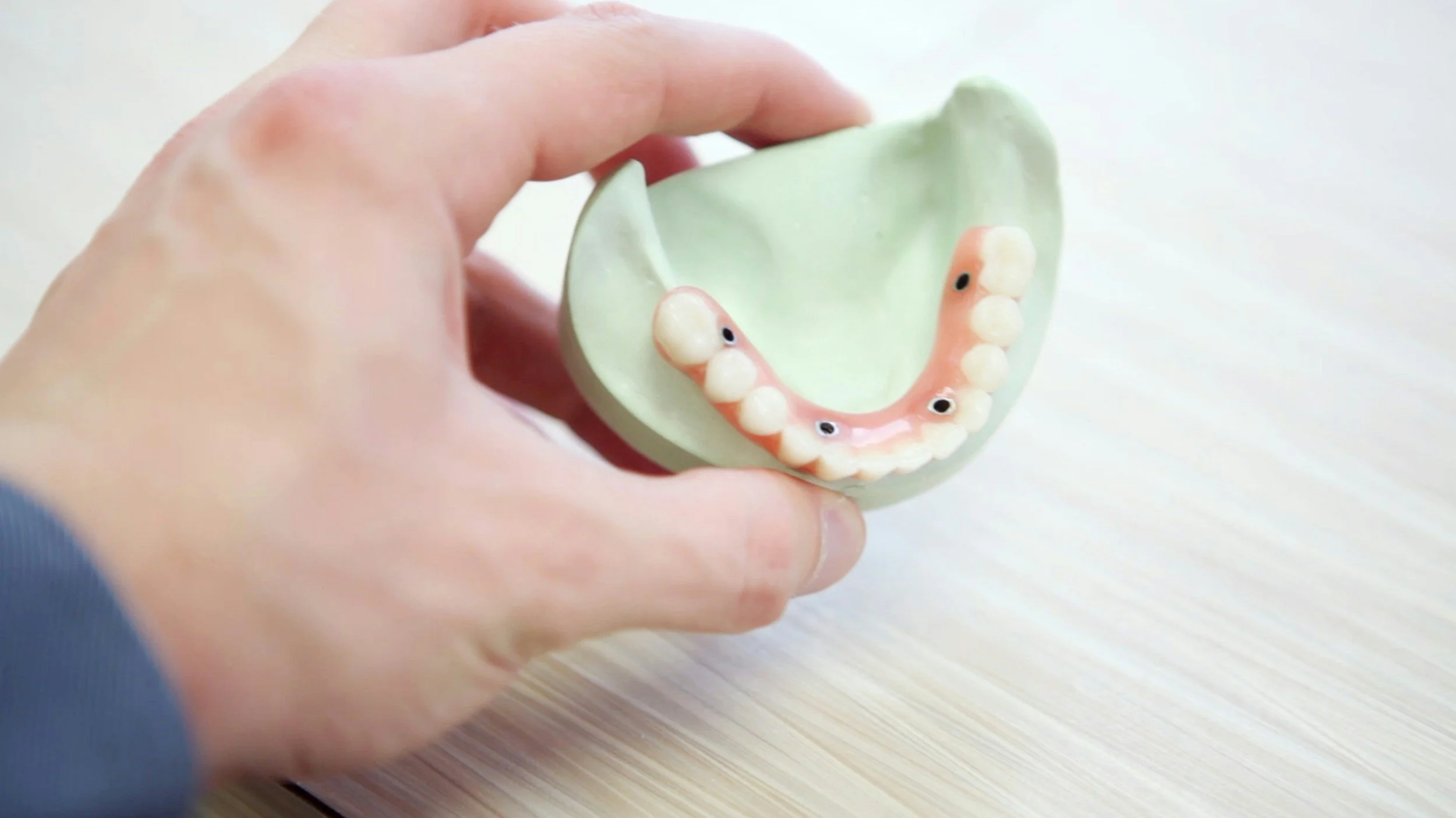 All-on-4 dental implant treatment