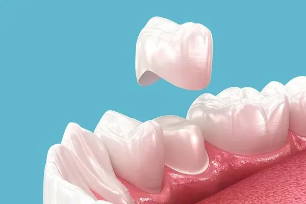Why Choose Zirconia Crowns?