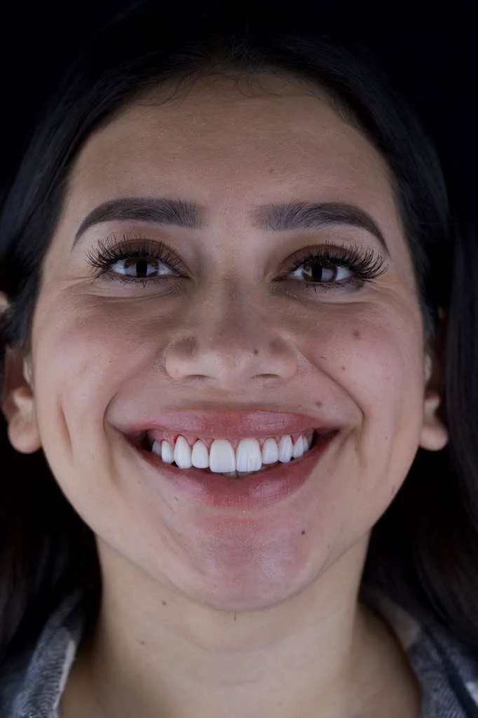 Dr. Borboa smile transformation 4