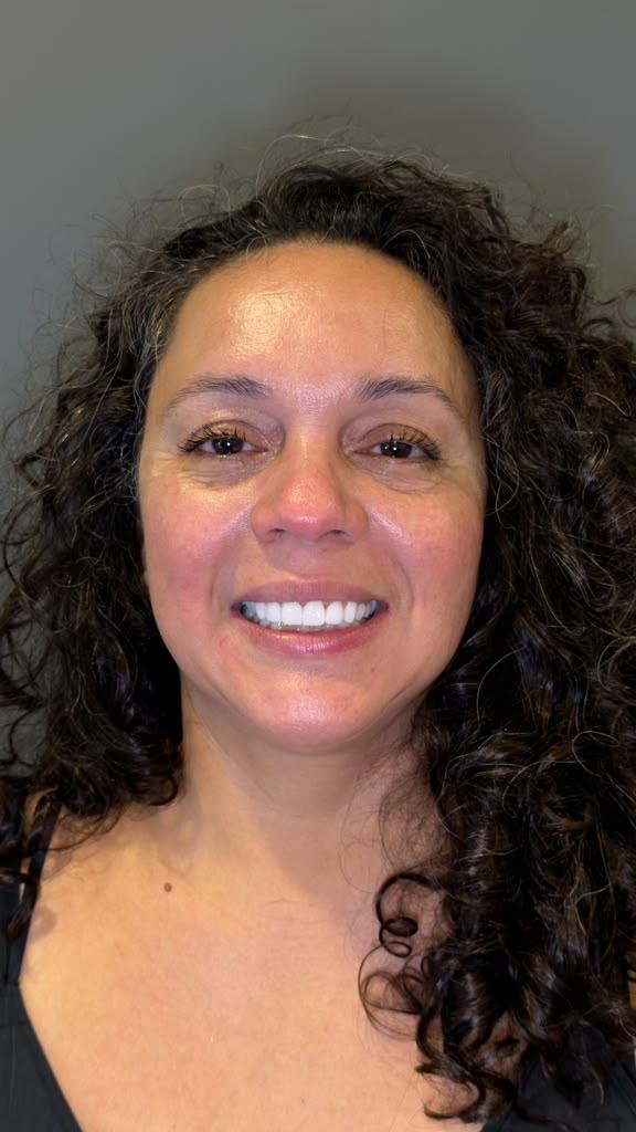 Smile makeover planning